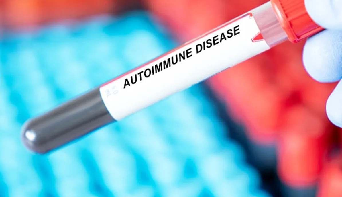 Autoimmune Diseases